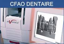 cfao dentaire