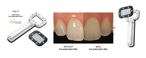 smilelite front image